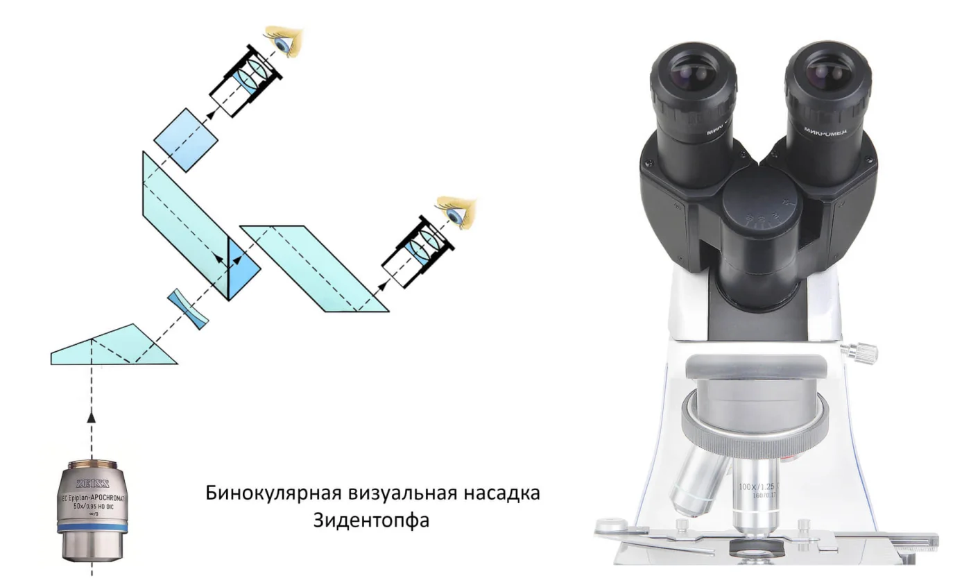 1- Sidentopf.jpg 1- Sidentopf.jpg