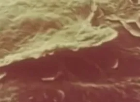 ороговевшая клетка кожи под микроскопом ороговевшая клетка кожи под микроскопом