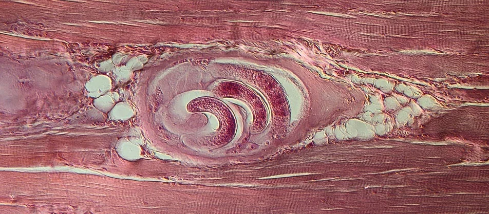 904_Trichinella02_1.jpg 904_Trichinella02_1.jpg
